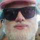 Dev Albino