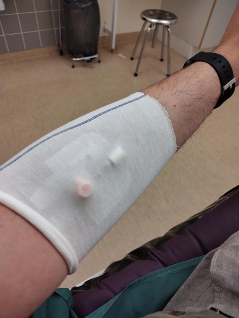 At the ER. Just got a needle... 