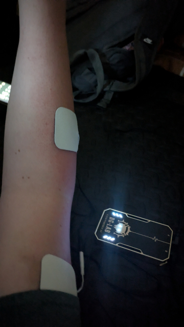 Photo of our hand with two square stick-on electrodes attached to it. A stylized shock controller sits on the floor nearby.