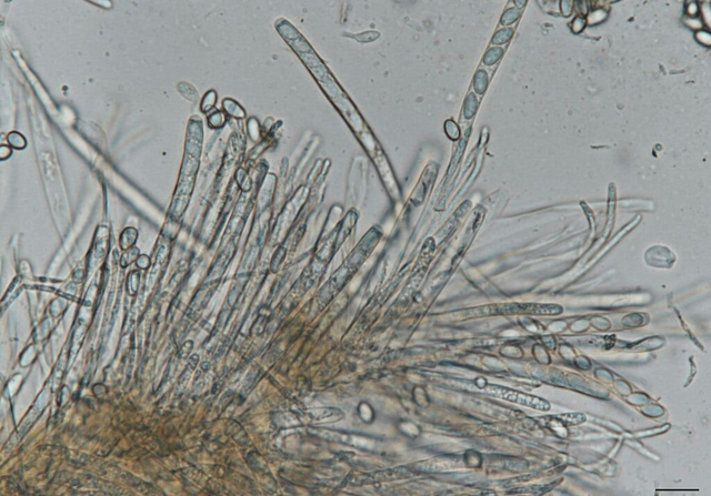 microscopic photo of threads of fungal spores