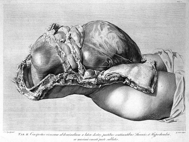 Engraving of a dissected figure during late pregnancy. The uterus is huge. Intestines are positioned above and behind it. 