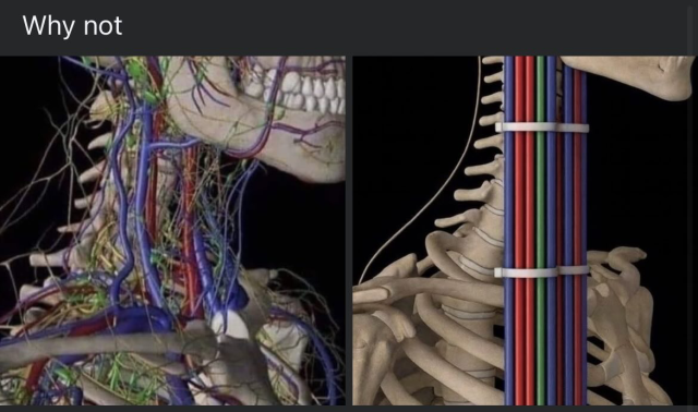 Side by side of of human skeleton with circulatory and nervous system on the left and on the right being replaced with multiple colored runs of CAT5 cable secured with tiptoes to the neck bones.