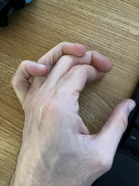 A picture of my left hand. The four long fingers are all crossed over each other: pinky over ring finger, ring over middle, and middle over index.